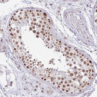 Immunohistochemical staining of human testis shows strong nuclear positivity in cells in seminiferous ducts.