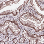 Immunohistochemical staining of human small intestine shows strong nuclear positivity in glandular cells.