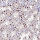 Immunohistochemical staining of human kidney shows strong nuclear positivity in cells in tubules.