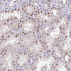 Anti-ZNF382 Antibody