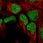 Immunofluorescent staining of human cell line HEK 293 shows localization to nuclear speckles.