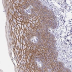 Immunohistochemical staining of human esophagus shows strong membranous positivity in squamous epithelial cells.