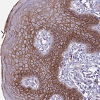 Immunohistochemical staining of human skin shows strong membranous positivity in squamous epithelial cells.
