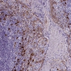 Immunohistochemical staining of human tonsil shows moderate membranous positivity in squamous epithelial cells and non-germinal center cells.