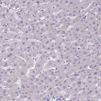 Anti-DSC3 Antibody