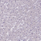 Immunohistochemical staining of human liver shows no membranous positivity in hepatocytes as expected.