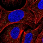 Immunofluorescent staining of human cell line U-2 OS shows localization to vesicles.