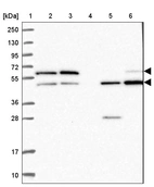Lane 1: Marker [kDa] 250, 130, 95, 72, 55, 36, 28, 17, 10_br/_Lane 2: Human cell line RT-4_br/_Lane 3: Human cell line U-251MG sp_br/_Lane 4: Human plasma (IgG/HSA depleted)_br/_Lane 5: Human liver tissue_br/_Lane 6: Human tonsil tissue
