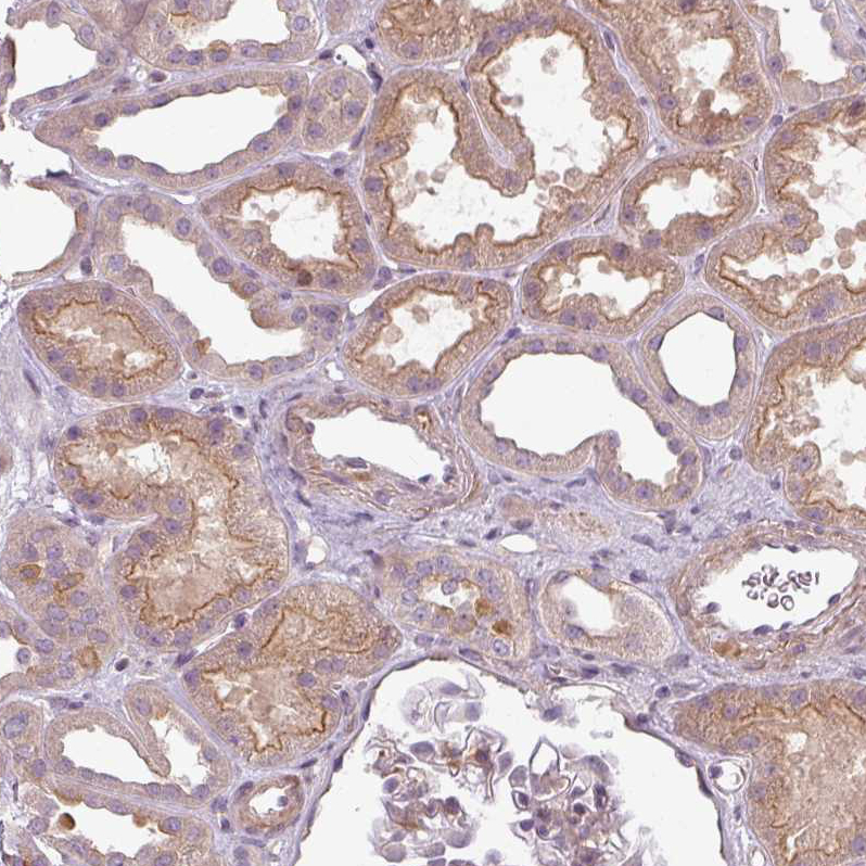 Anti-SLC16A9 Antibody