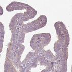 Immunohistochemical staining of human Fallopian tube shows weak positivity in apical membrane in glandular cells.