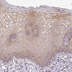 Immunohistochemical staining of human cervix shows weak membranous positivity in squamous epithelial cells.
