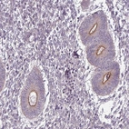 Immunohistochemical staining of human endometrium shows moderate positivity in apical membrane in glandular cells.