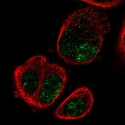 Immunofluorescent staining of human cell line PC-3 shows localization to nucleus.
