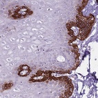 Anti-CNPPD1 Antibody