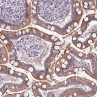 Anti-ACAP3 Antibody