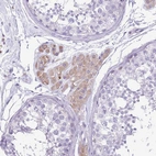 Anti-KCTD19 Antibody