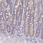 Immunohistochemical staining of human duodenum shows weak to moderate cytoplasmic positivity in glandular cells.