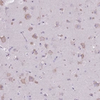 Immunohistochemical staining of human cerebral cortex shows moderate cytoplasmic positivity in neurons.
