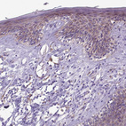 Immunohistochemical staining of human skin shows weak cytoplasmic positivity in squamous epithelial cells.