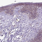 Immunohistochemical staining of human skin shows weak cytoplasmic positivity in squamous epithelial cells.