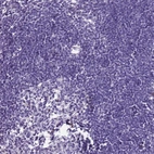 Immunohistochemical staining of human lymph node shows no positivity in non-germinal center cells as expected.