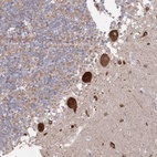 Anti-BTBD18 Antibody