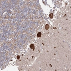 Anti-BTBD18 Antibody