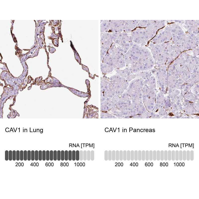 Anti-CAV1 Antibody