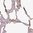 Immunohistochemical staining of human lung shows strong membranous positivity in pneumocytes.
