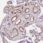 Immunohistochemical staining of human placenta shows strong membranous positivity in endothelial cells.