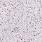 Immunohistochemical staining of human liver shows moderate membranous positivity in hepatic sinusoid cells.