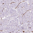 Immunohistochemical staining of human pancreas shows no positivity in exocrine glandular cells as expected.