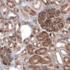 Immunohistochemical staining of human kidney shows moderate to strong cytoplasmic immunoreactivity in cells in tubules, as well as strong positivity in glomeruli.
