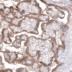 Immunohistochemical staining of human placenta shows moderate cytoplasmic positivity in trophoblastic cells.