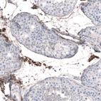 Immunohistochemical staining of human testis shows moderate to strong granular cytoplasmic positivity in Leydig cells.