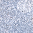 Immunohistochemical staining of human tonsil shows no positivity in lymphoid cells as expected.