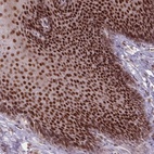 Anti-OR10C1 Antibody