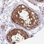 Anti-CDIP1 Antibody