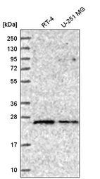 Western blot analysis in human cell line RT-4 and human cell line U-251 MG.