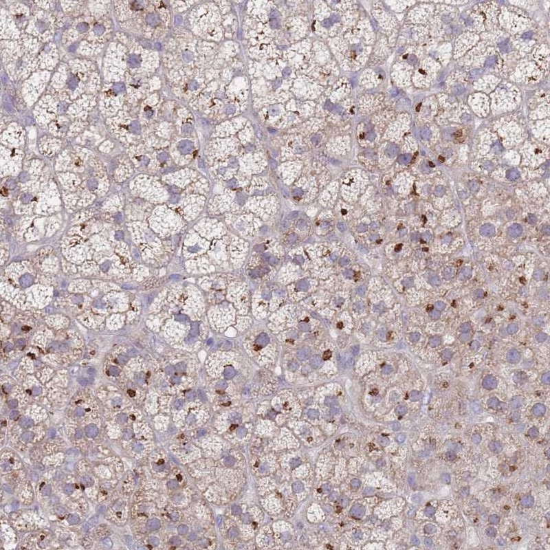 Anti-AKAIN1 Antibody