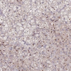 Anti-AKAIN1 Antibody