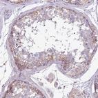 Immunohistochemical staining of human testis shows weak to moderate membranous positivity in cells in seminiferous ducts.