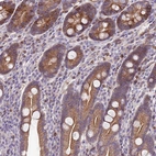 Immunohistochemical staining of human duodenum shows weak to moderate cytoplasmic positivity in glandular cells.
