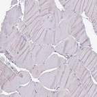 Immunohistochemical staining of human skeletal muscle shows no positivity in myocytes as expected.