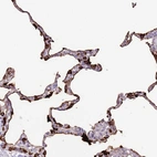 Anti-SFTPA1 Antibody
