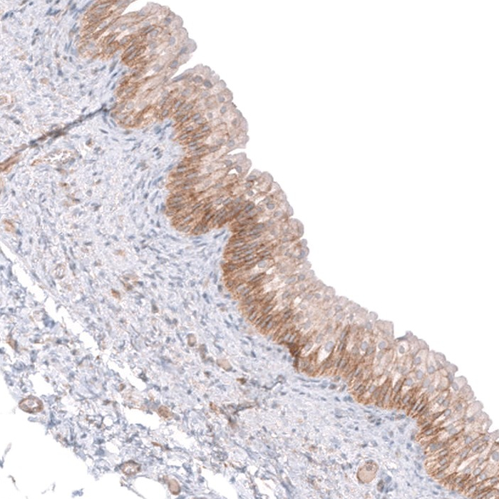 Anti-C16orf74 Antibody