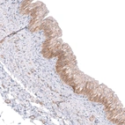Anti-C16orf74 Antibody