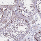 Anti-BCL9L Antibody