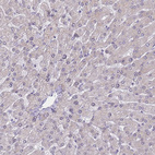 Immunohistochemical staining of human liver shows no positivity in hepatocytes as expected.