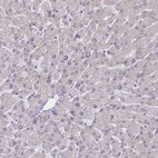 Immunohistochemical staining of human liver shows no positivity in hepatocytes as expected.